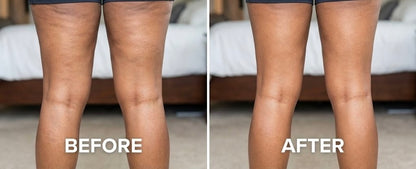 ANTI-CELLULITE MASSAGE OIL™