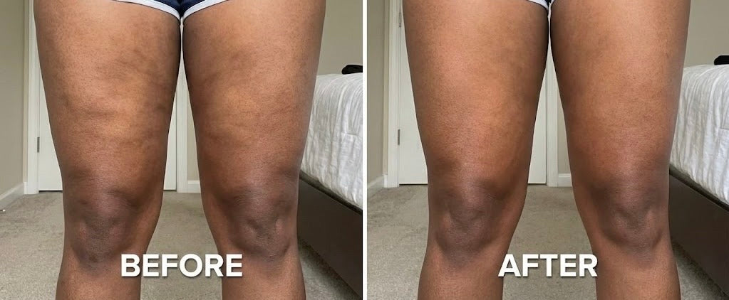 ANTI-CELLULITE MASSAGE OIL™