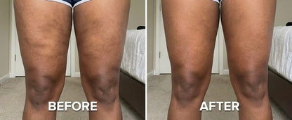 ANTI-CELLULITE MASSAGE OIL™