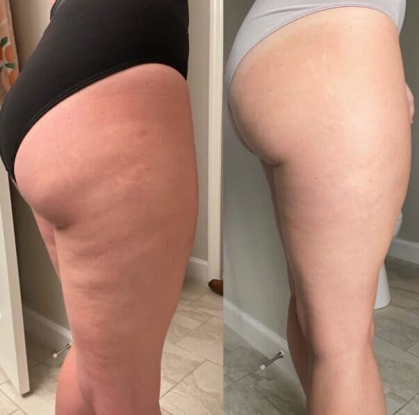 ANTI-CELLULITE MASSAGE OIL™