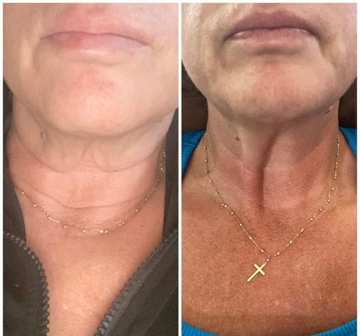 ANTI-CELLULITE MASSAGE OIL™