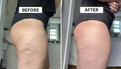 ANTI-CELLULITE MASSAGE OIL™