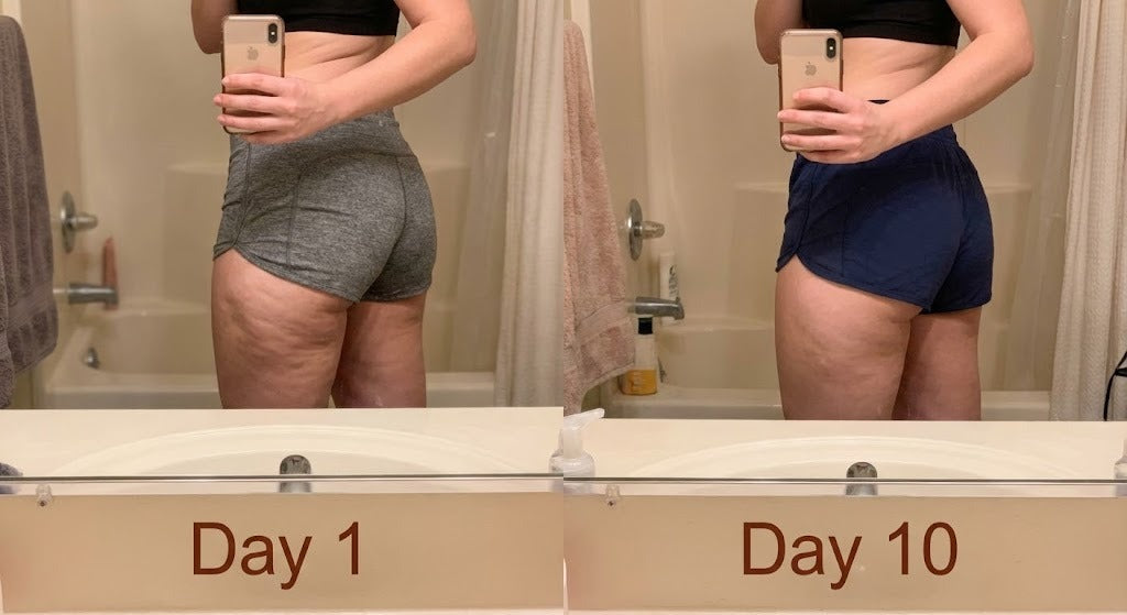 ANTI-CELLULITE MASSAGE OIL™